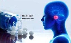Как понтинный миелинолиз влияет на центральную нервную систему?